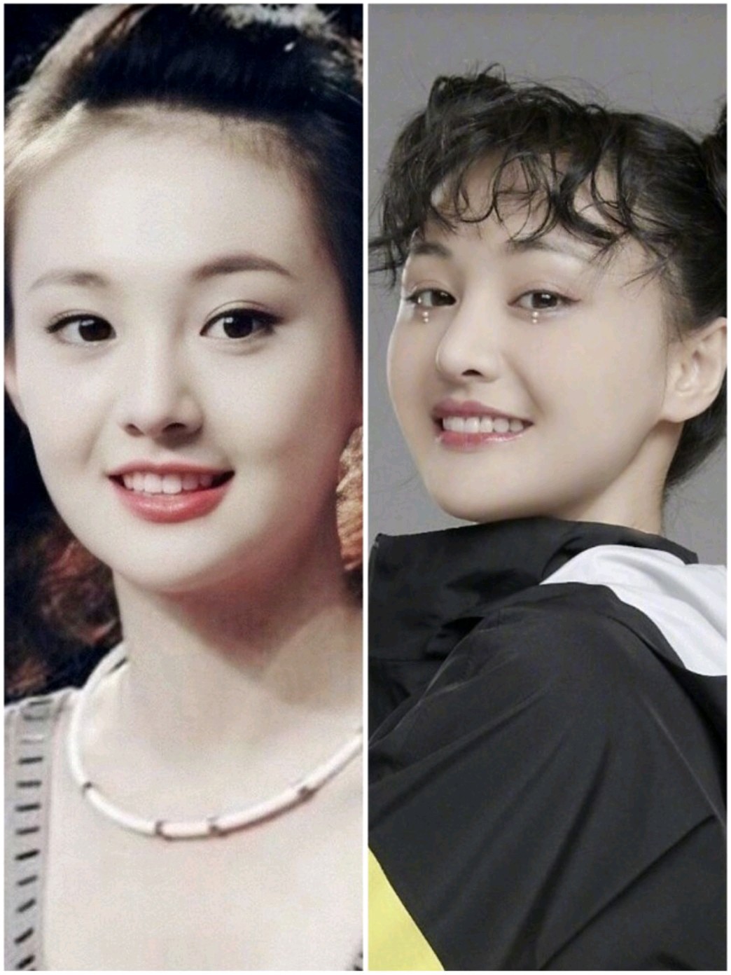 五官分析郑爽整容前后的颜值你get哪一个?