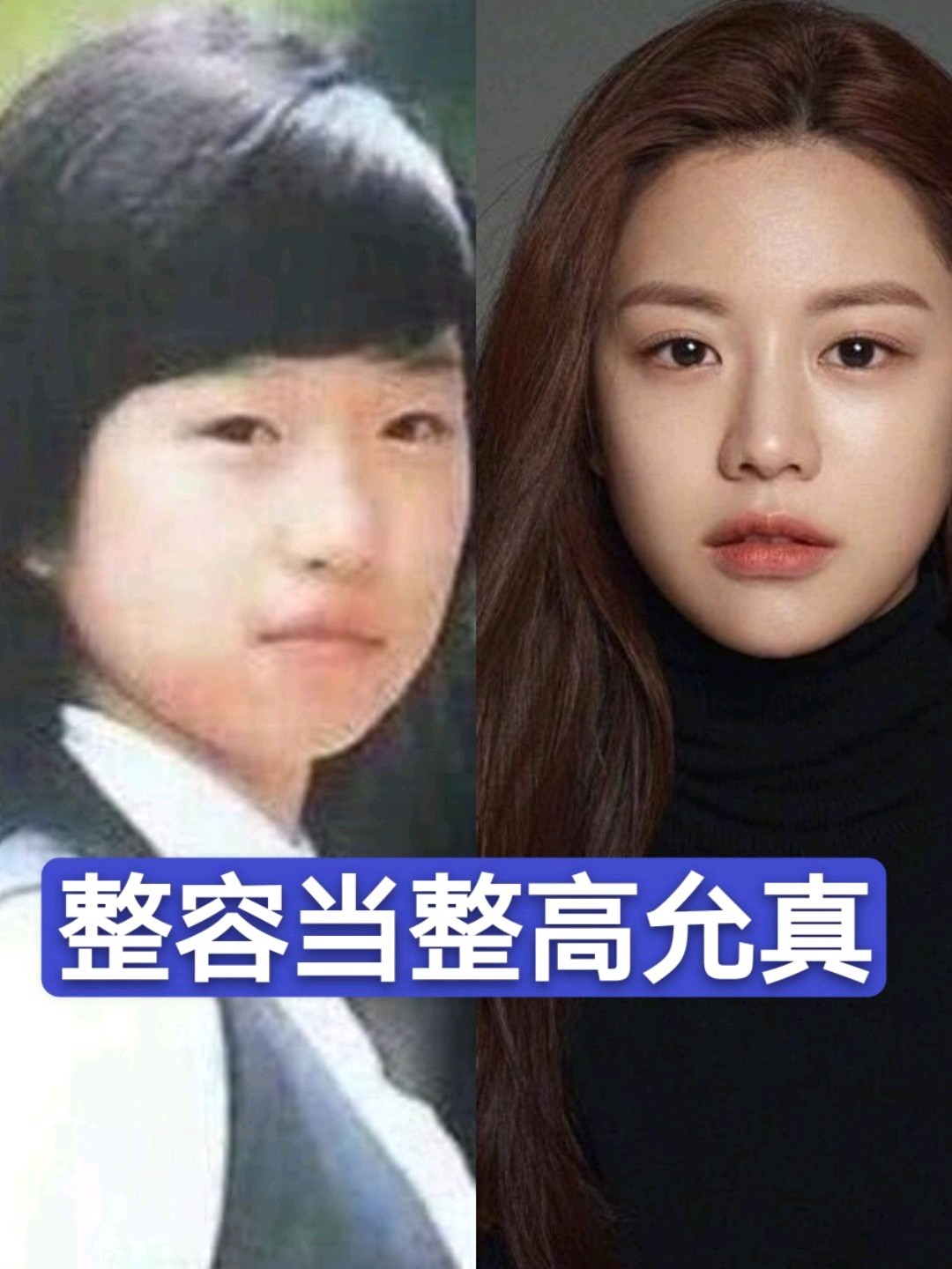 韩国整容模板高允真