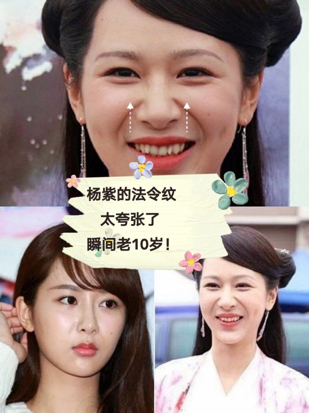 杨紫年纪轻轻,为什么法令纹这么重真的超显老