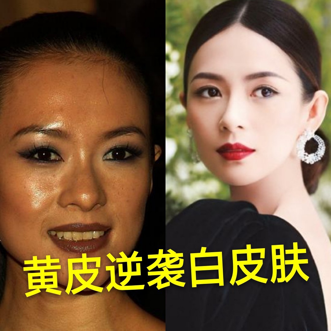 大家有经历过黄皮肤或者黝黑皮肤给你带来的困扰吗?