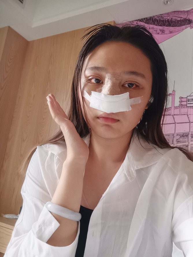 术后3天眼睛上面贴的纱布已经取了,现在可以看见双眼_圈子-新氧美容