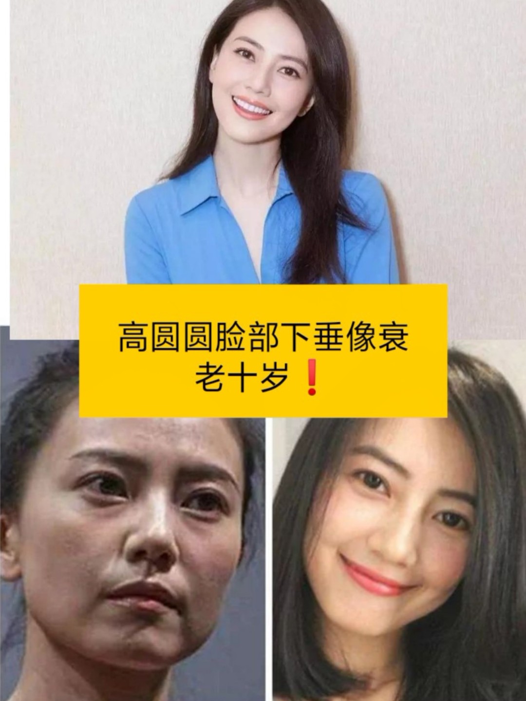 8080说起高圆圆,大概是不少人心目中的女神了,美丽年_圈子-新氧