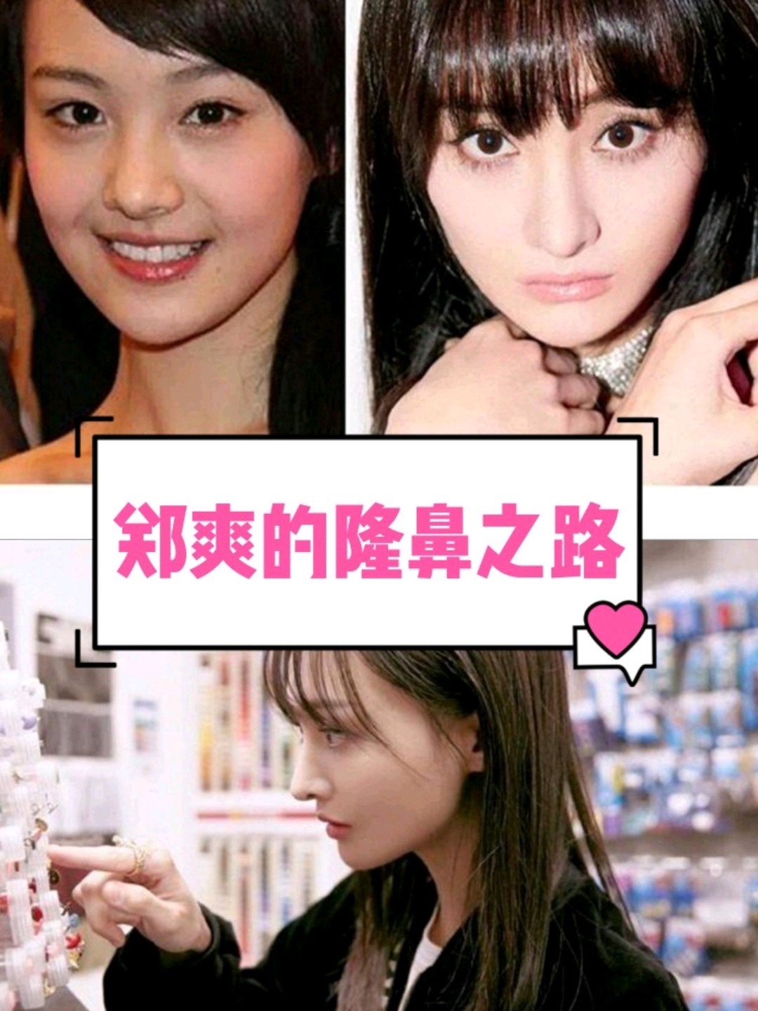 91郑爽的鼻子主要问题在于,鼻梁和山根垫得高,鼻尖也_圈子-新氧美容