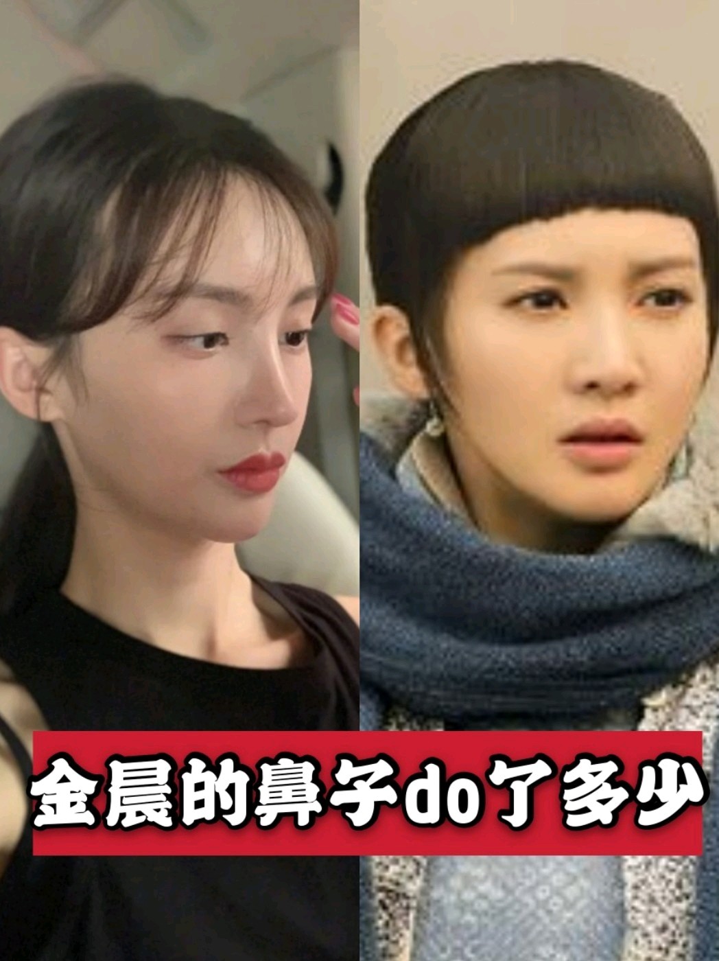 金晨的鼻子do了多少