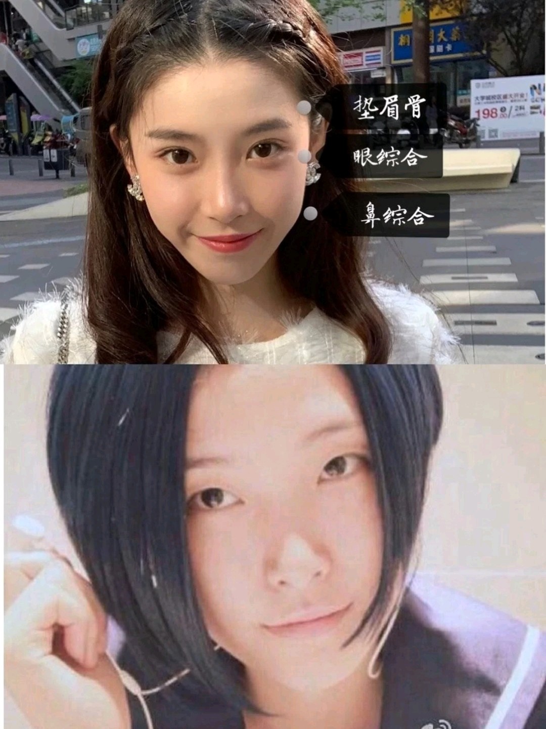 撞脸iu的半藏森林到底有什么魅力7187深扒绿茶整容史_圈子-新氧