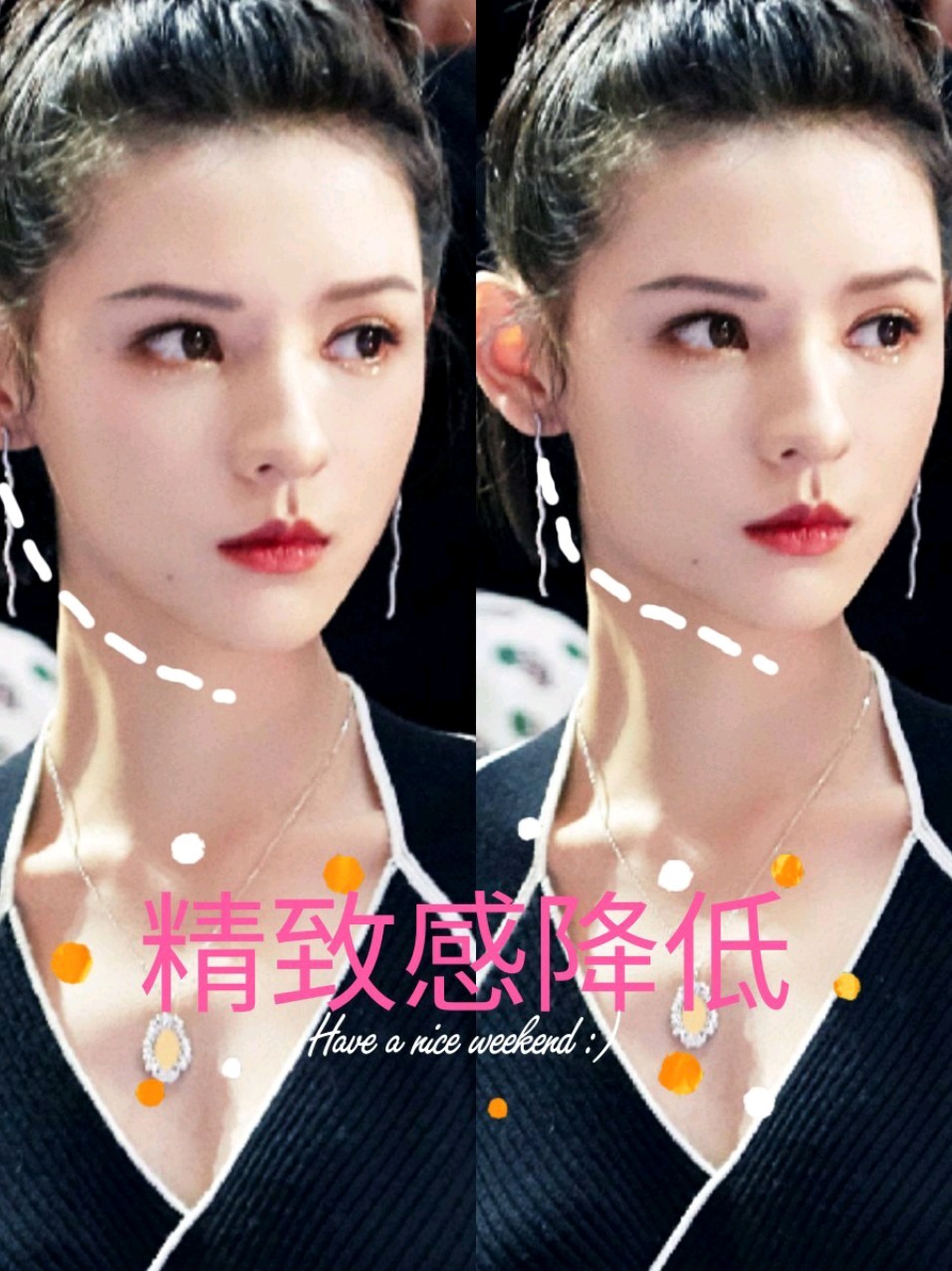 侧颜美是由完美的下颌角弧度来起到决定性作用的一个好看的下颌角可以