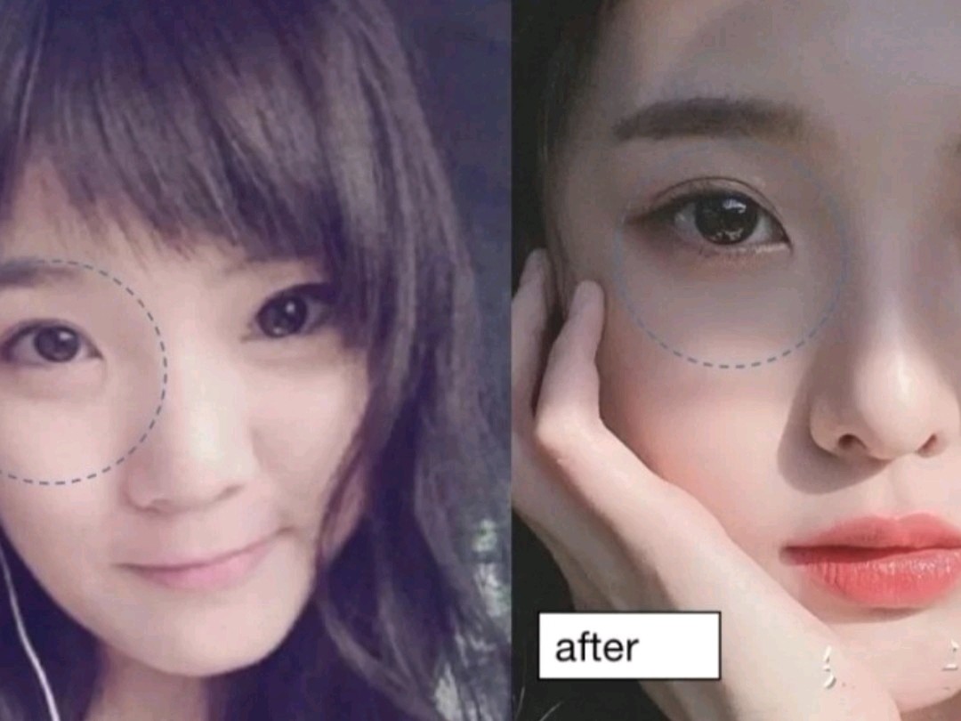 nene被爆整容青纯女生形象不再