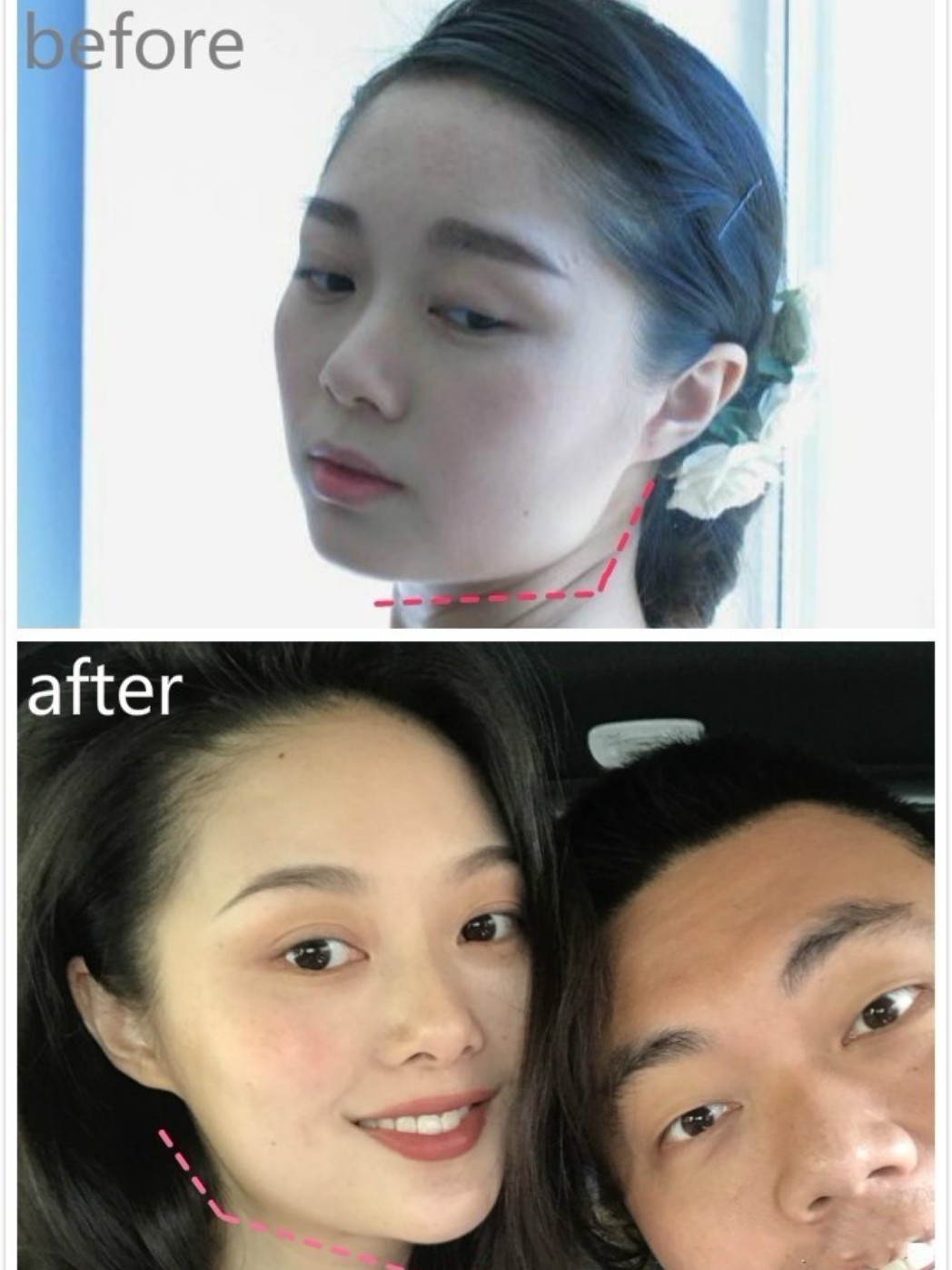 晚晚的"富婆"气质靠整形71整形也能改变气质73#谁是_圈子-新氧