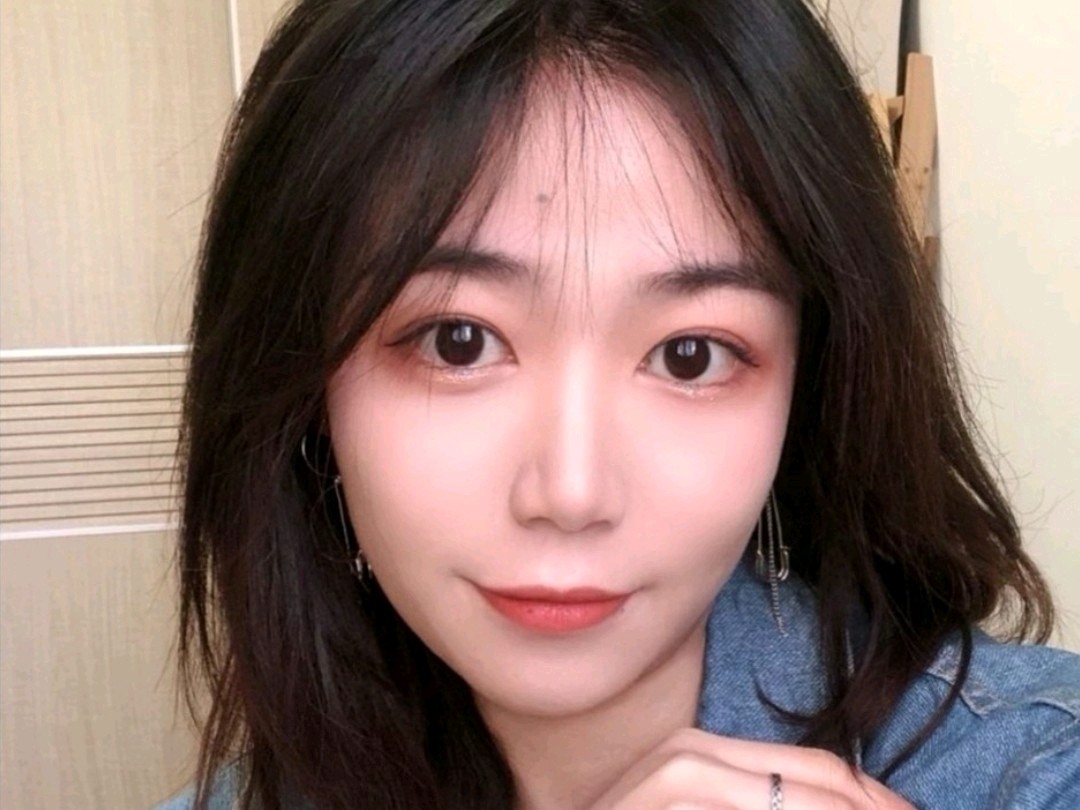 【神线医疗美容埋线双眼皮术后15天】