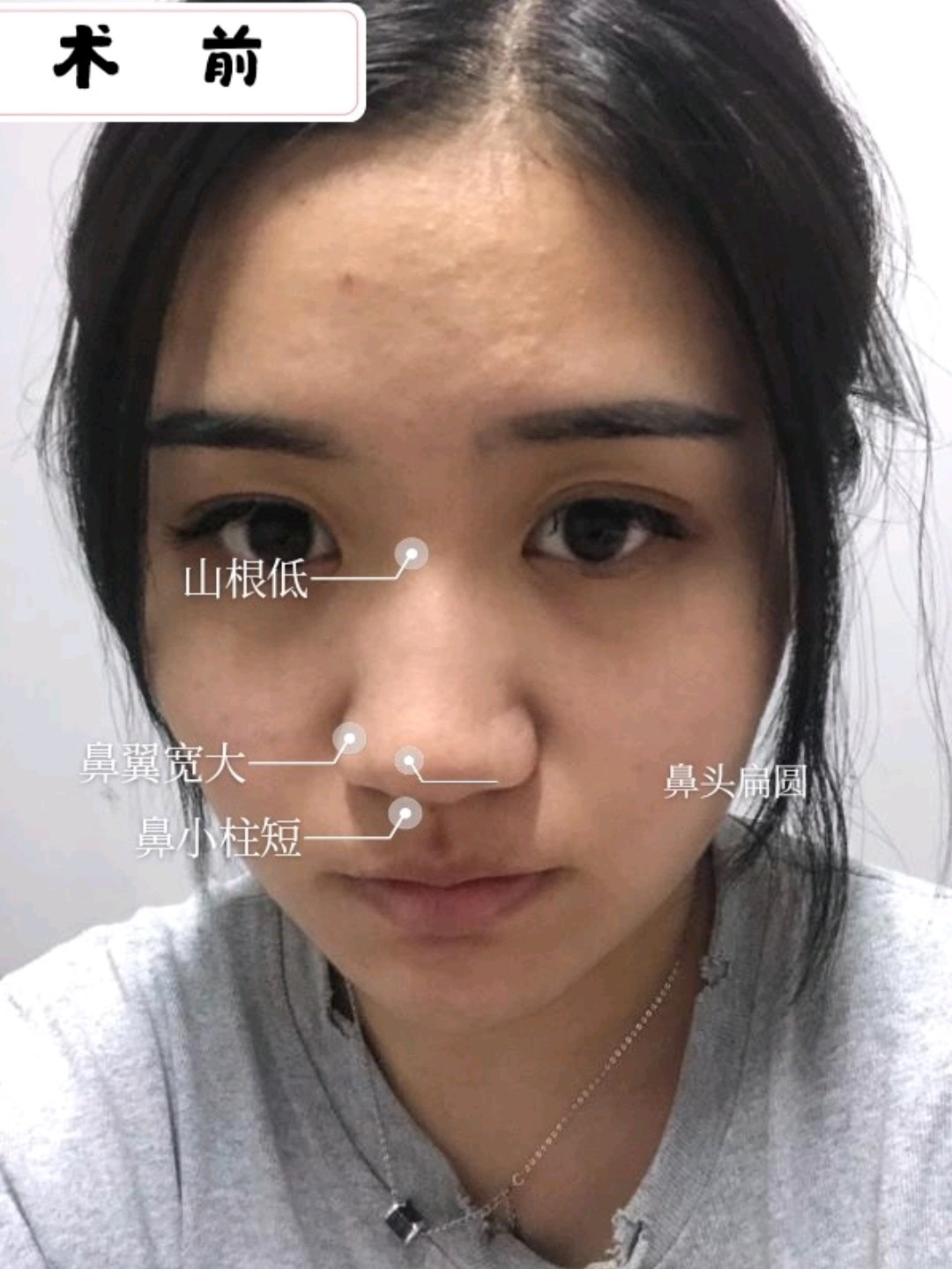 拯救塌鼻梁 蒜头鼻 气场全开