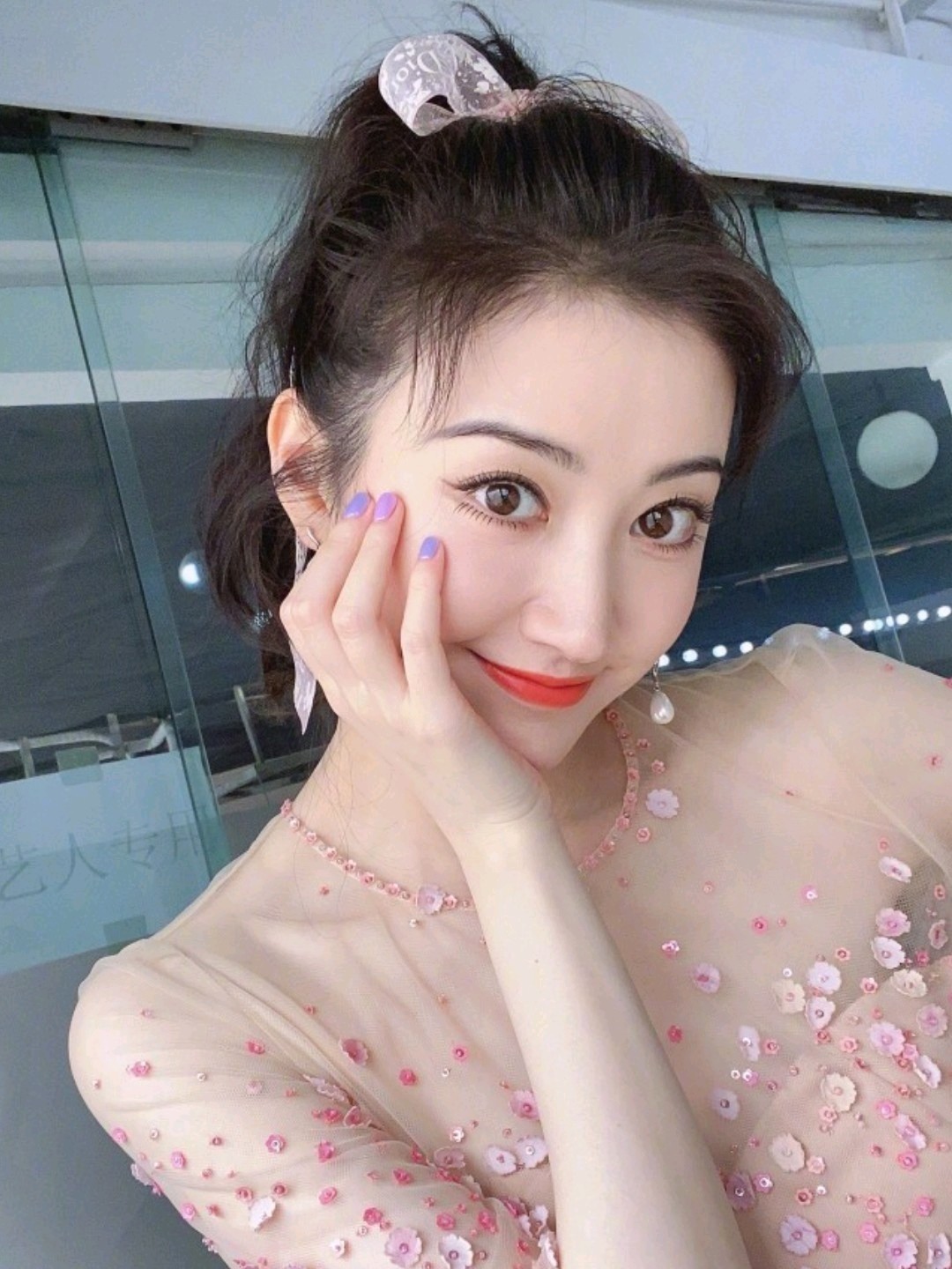 如何拥有好看的双眼皮景甜双眼皮修复太成功了吧!