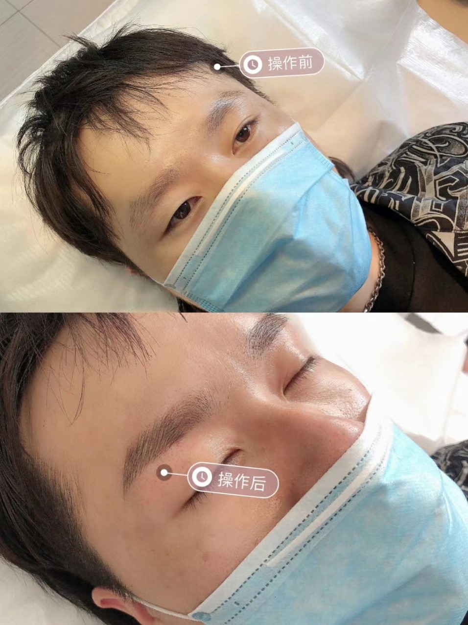 老听人说,男人眉毛散会影响各种运势,而且确实眉毛淡_圈子-新氧美容