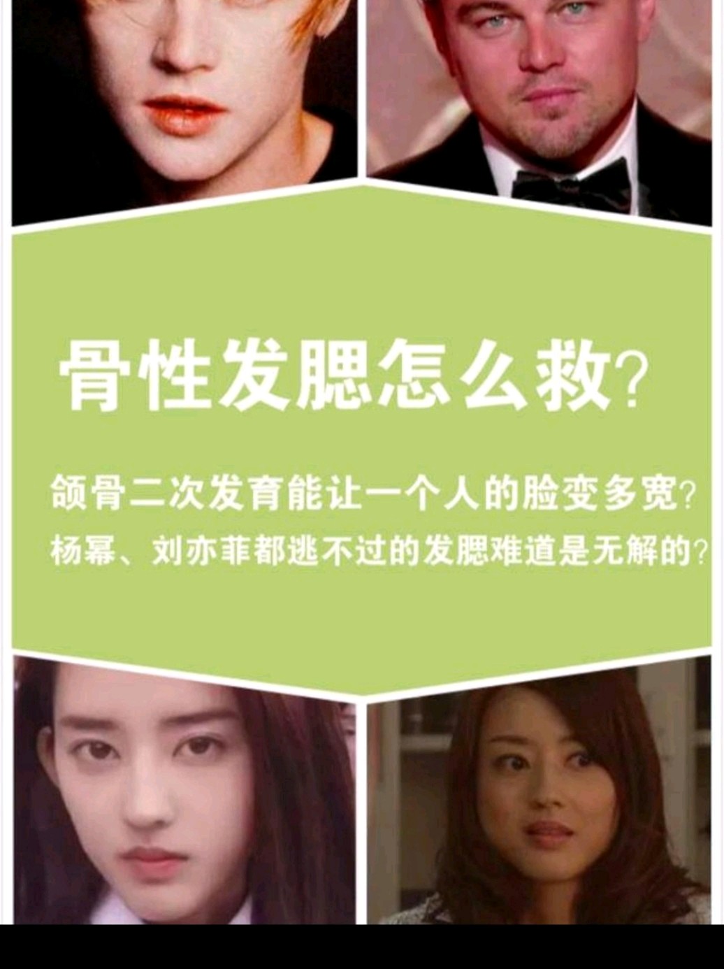 发腮不是发福发腮是光脸大下颌横着宽