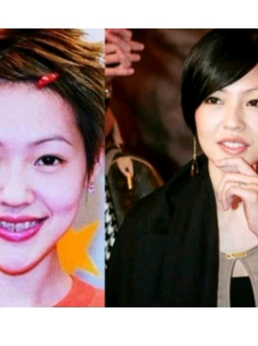 整个牙而已为啥高圆圆小s 整牙前后如同整形