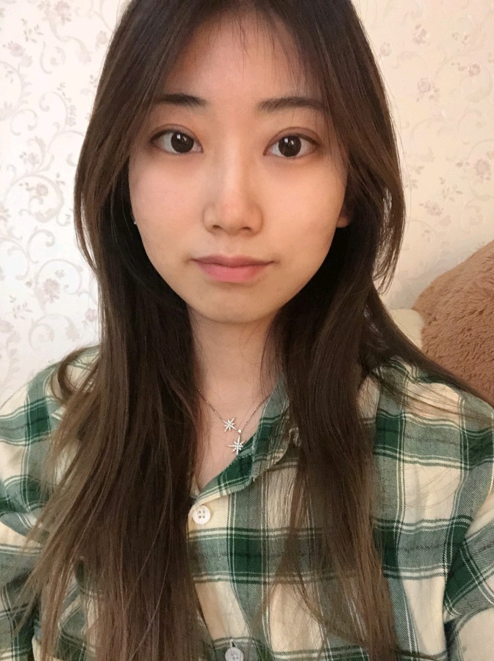 眼球凸双眼皮怎么做好看?