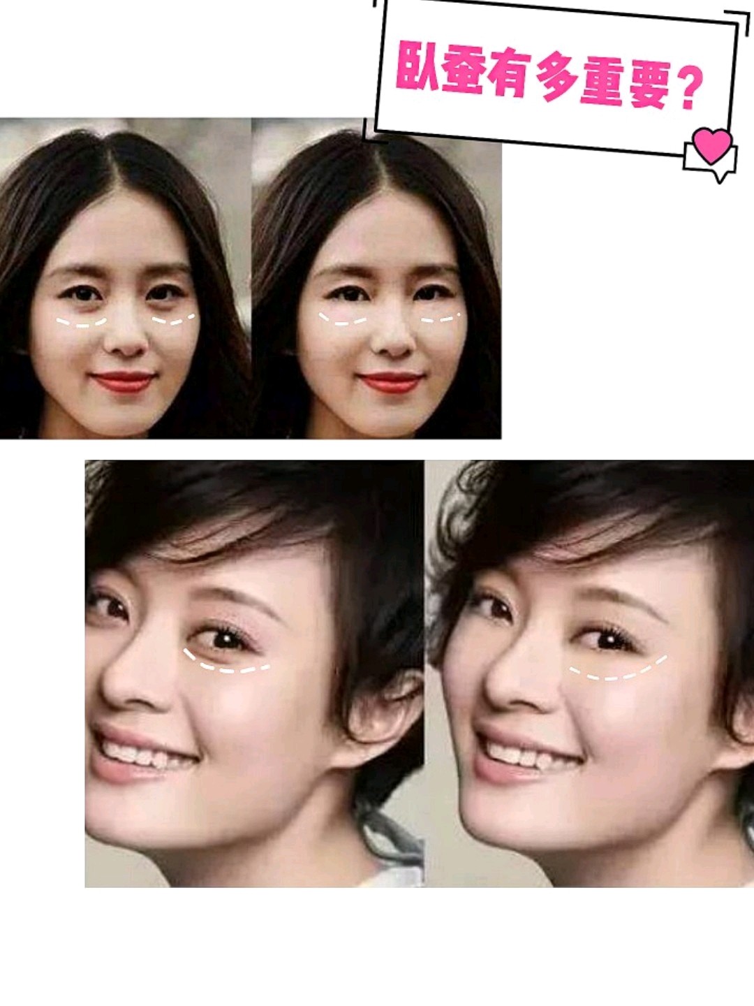 现在的妹子基本上都是有卧蚕的,你有木有发现,大家对_圈子-新氧美容