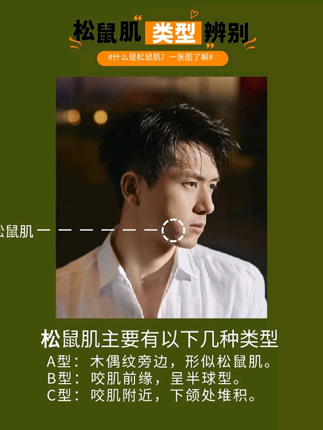 李现嘴角鼓鼓的是婴儿肥?松鼠肌你知道吗