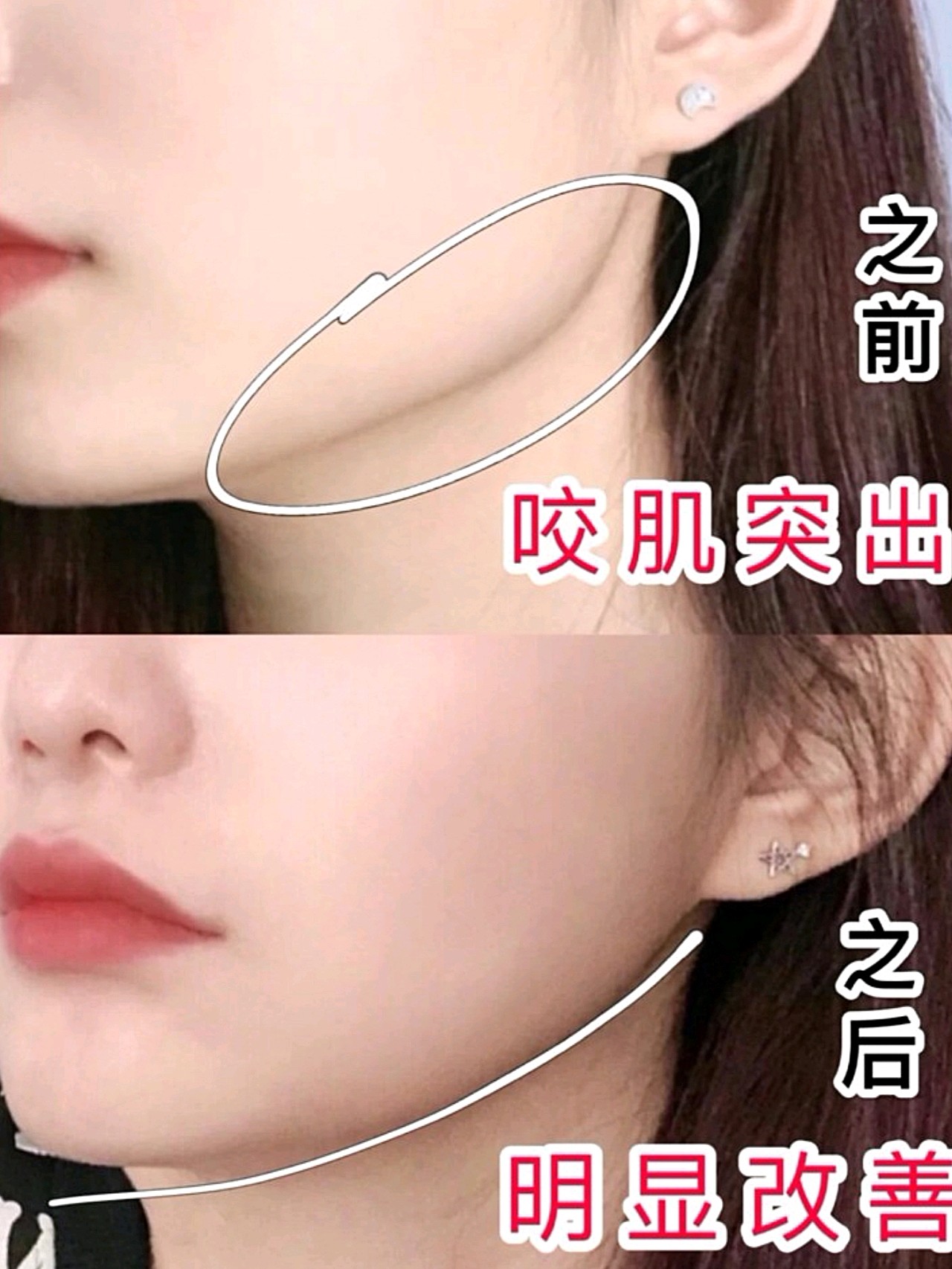 亲测有效的懒人瘦咬肌教程60效果超明显60