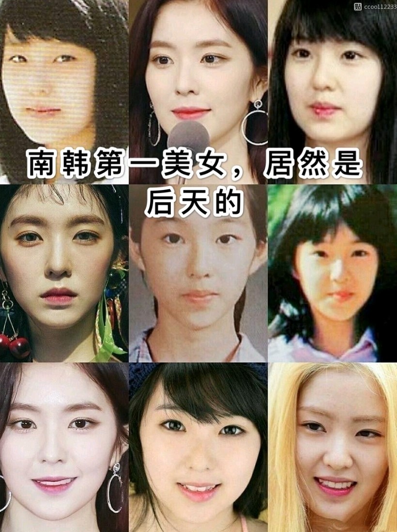 裴珠泫!一个妈生脸的整容模版