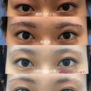 十一鸭的个人主页 新氧整形