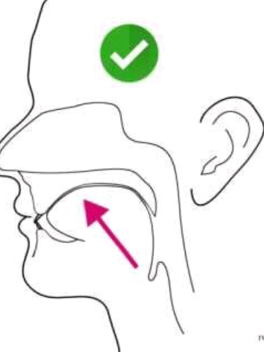 如何矫正口呼吸71你们平时舌头是怎么放在嘴里的71原来_圈子-新氧