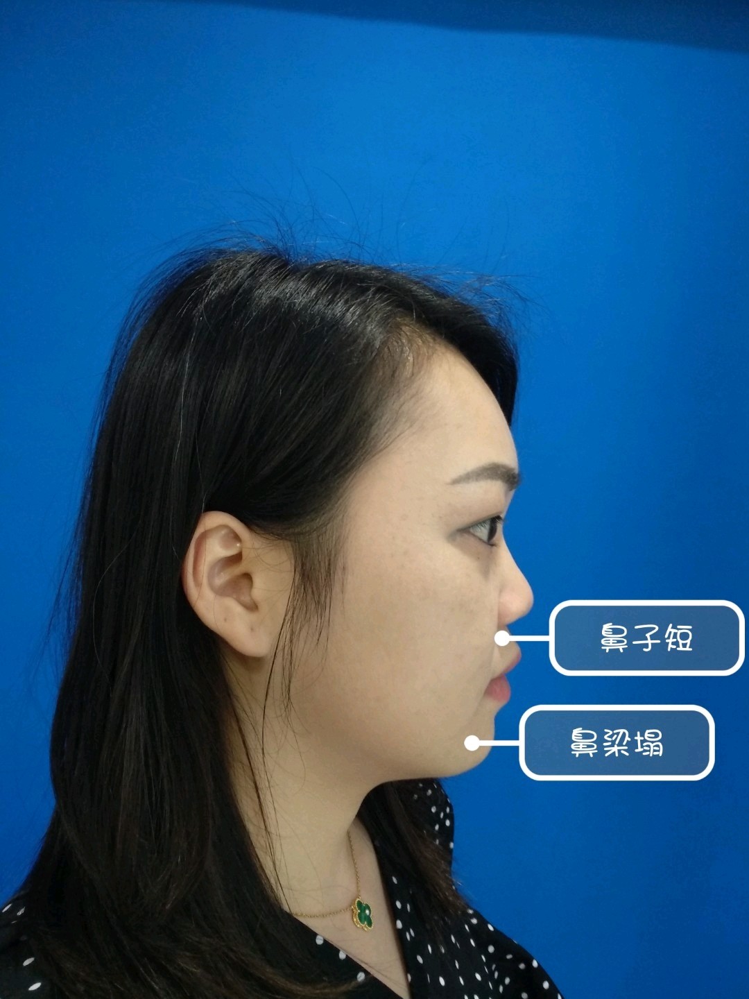 波型鼻图片