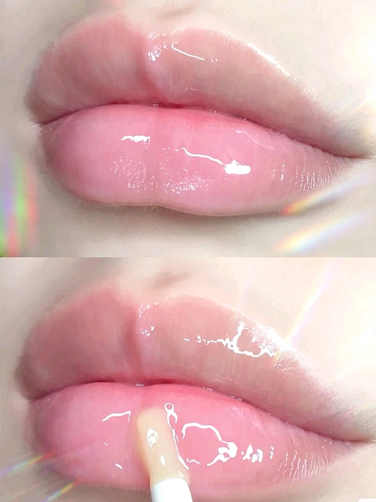 现在巨流行破尿酸丰唇 为啥这么多人选择丰唇 圈子 新氧美容整形