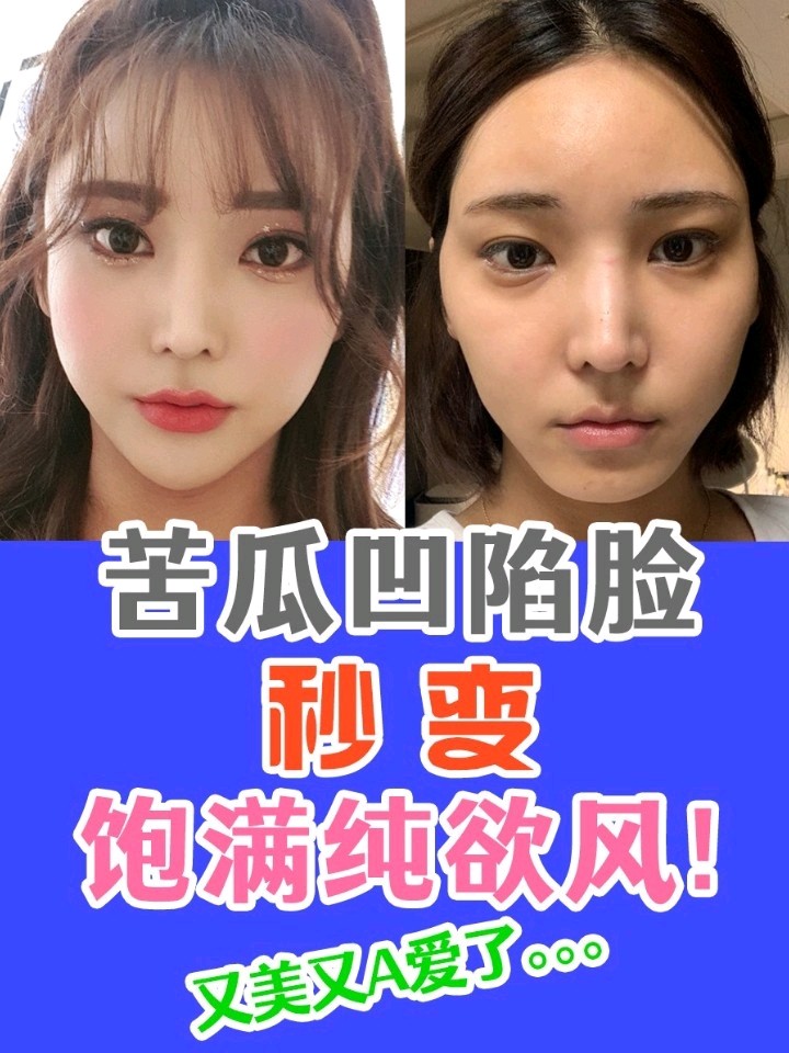 苦瓜凹陷脸秒变饱满纯欲风!又美又a爱了.