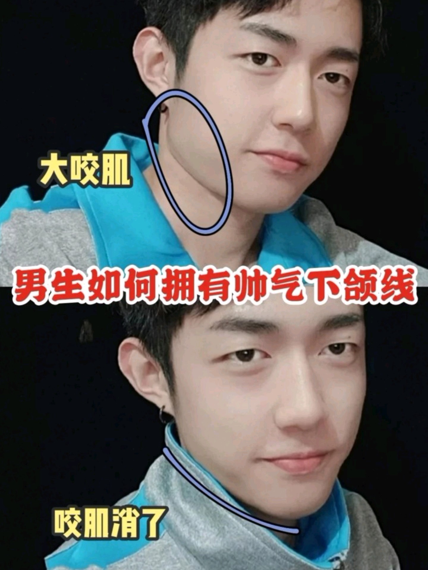 如何拥有帅气侧脸71男生瘦脸计划开启75