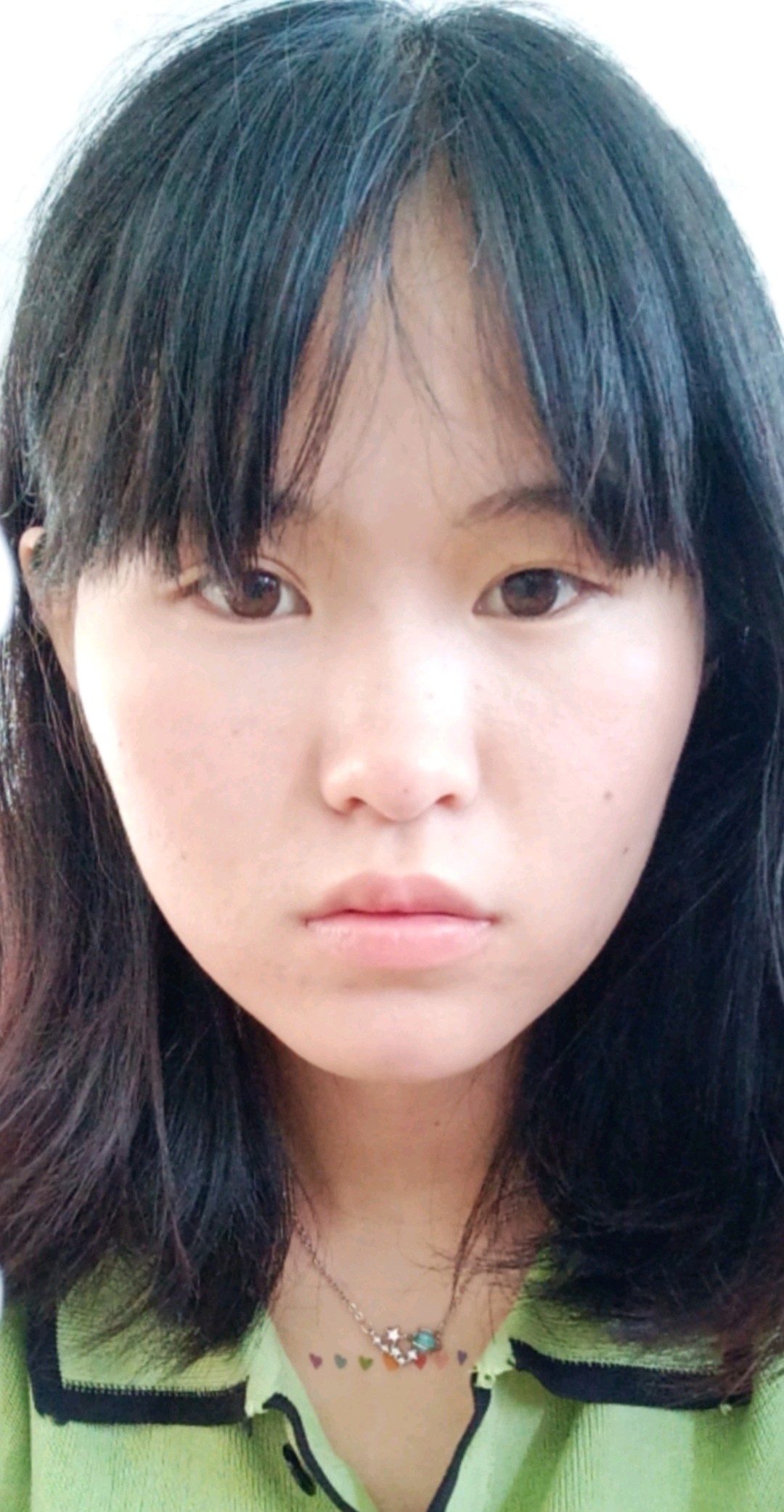 因为我眼睛一大一小一单一双所以我右边脸有点塌陷怎么办这样子整容会