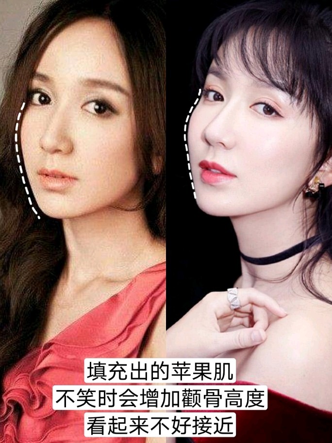 什么样的苹果肌最有少女感?