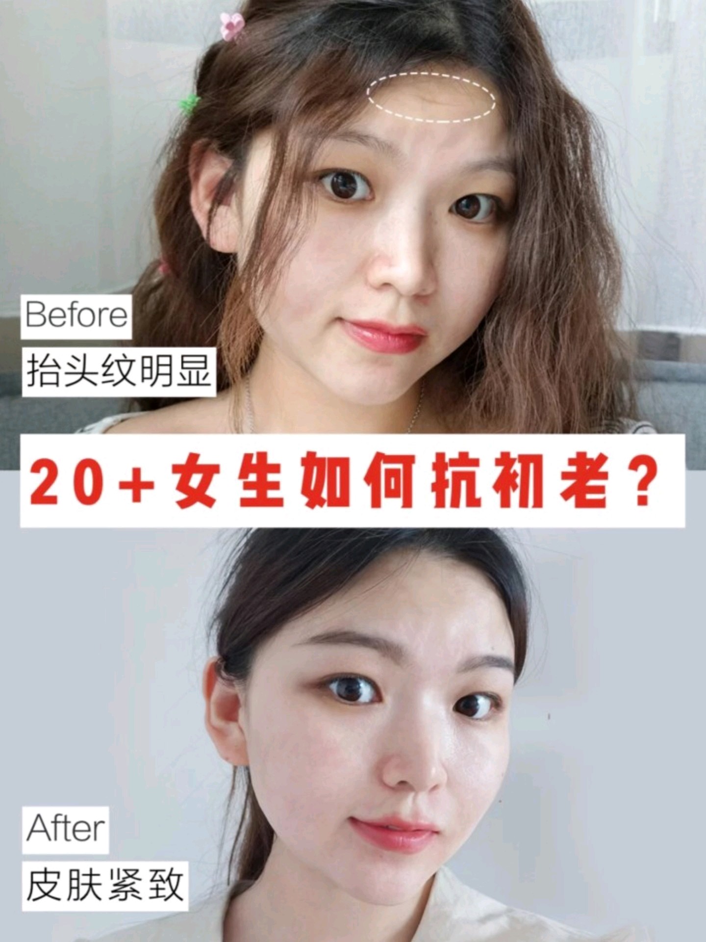 20 抗初老幹貨5步搞定額頭紋,法令紋