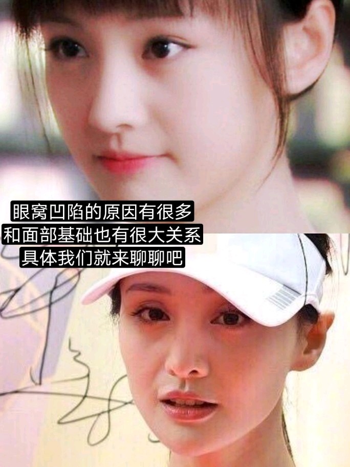 郑爽又老了?这次问题太大了吧!