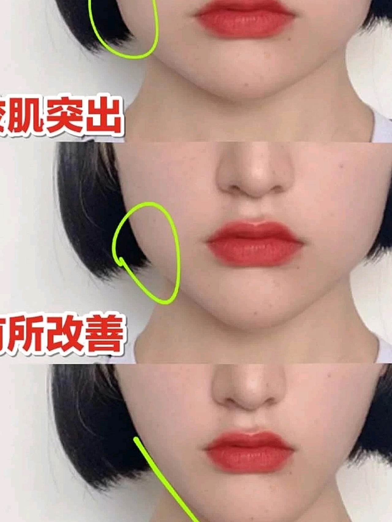 十五天改善咬肌大脸瘦成迷人初恋脸?