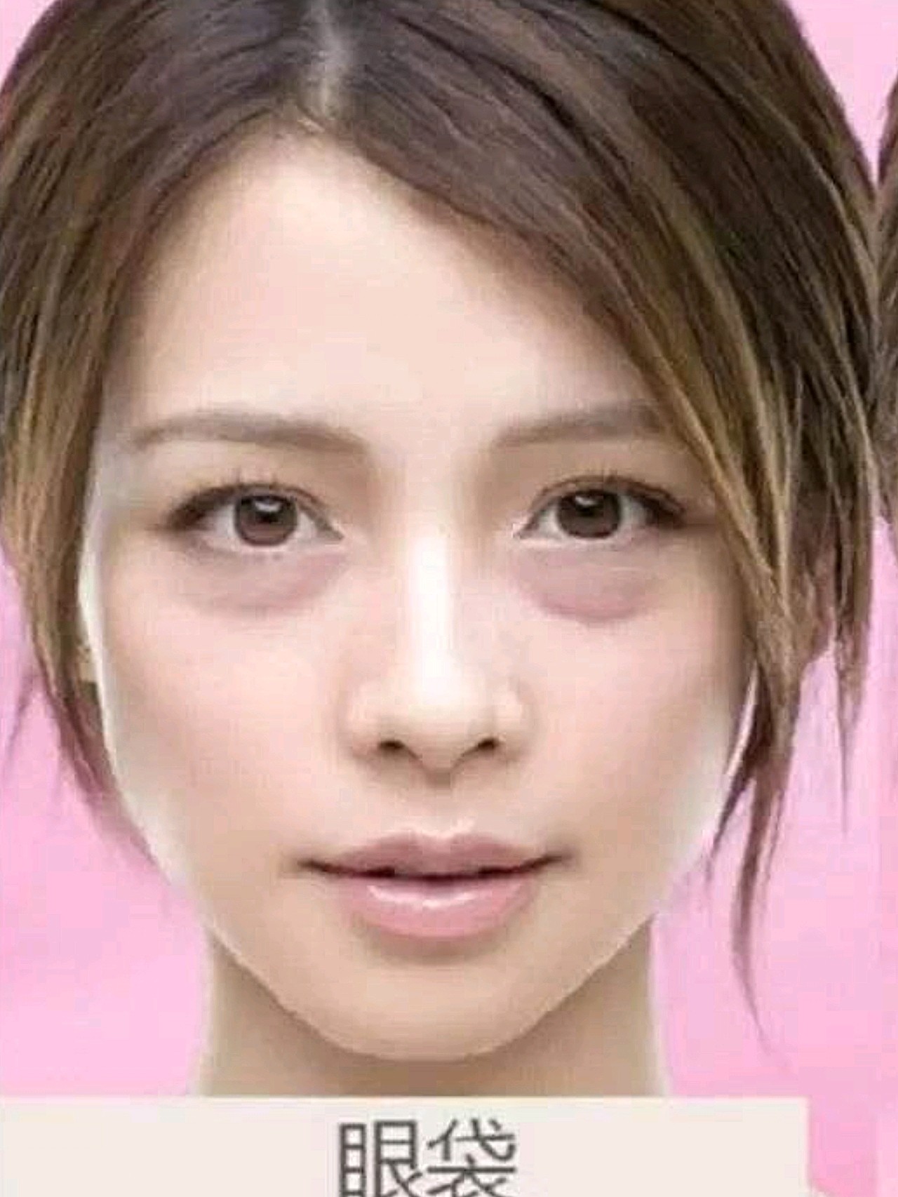 有不少妹子容易把眼袋和卧蚕弄混,那么真的眼袋到底是什么样的呢?