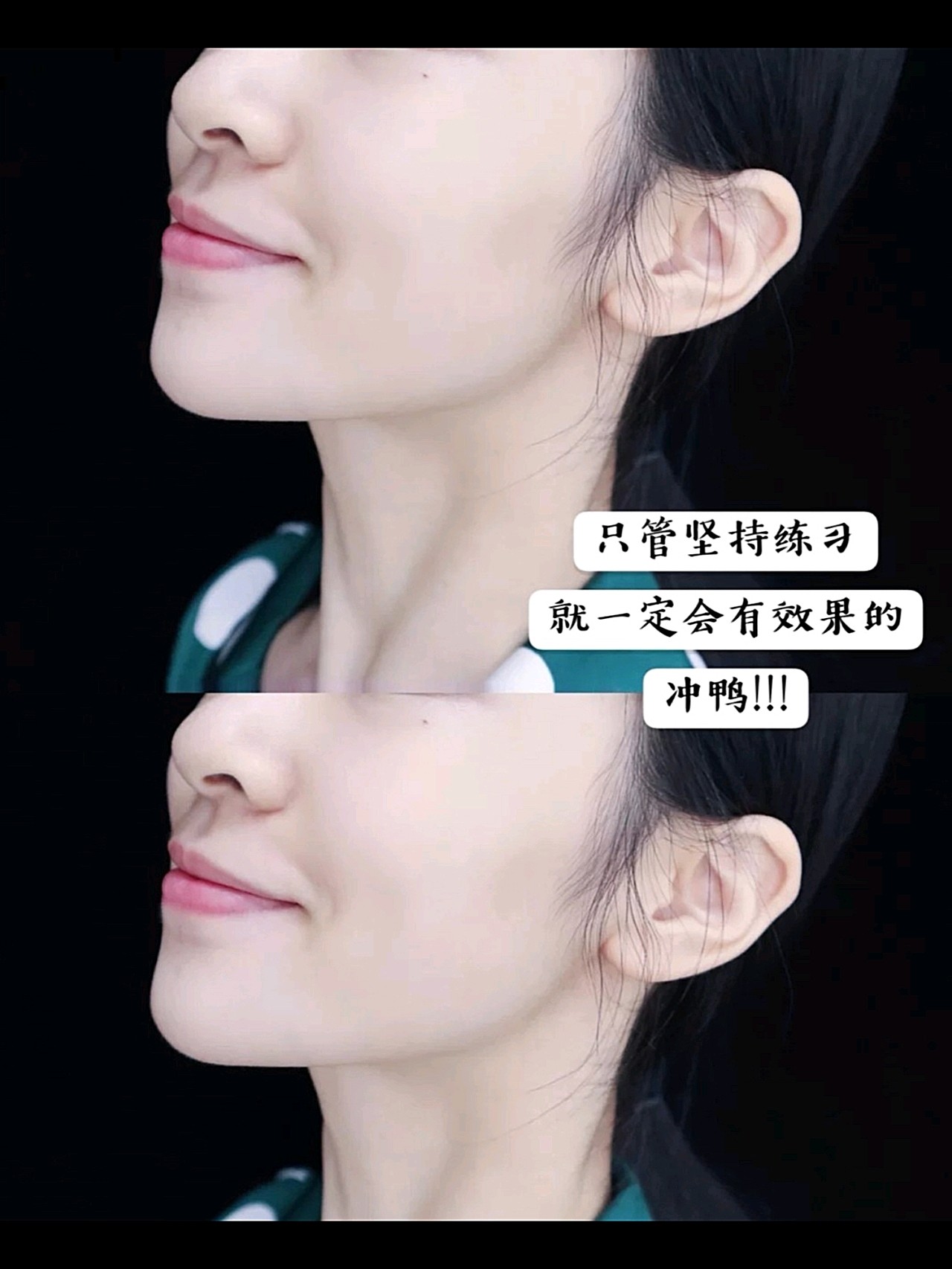 下颚线养成记|瘦脸瘦双下巴局部塑形分享