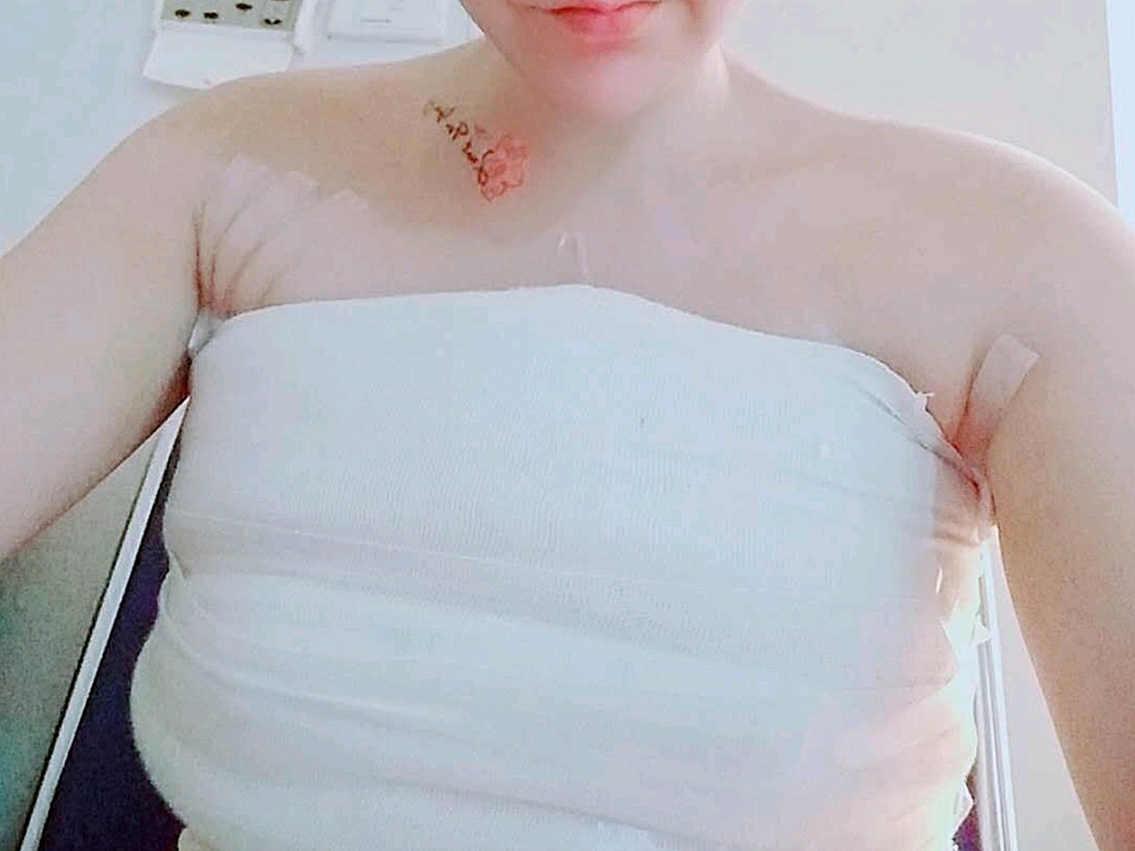 刚做完那一两天,胸口绑着绷带,就像穿了一个盔甲一样_圈子-新氧美容