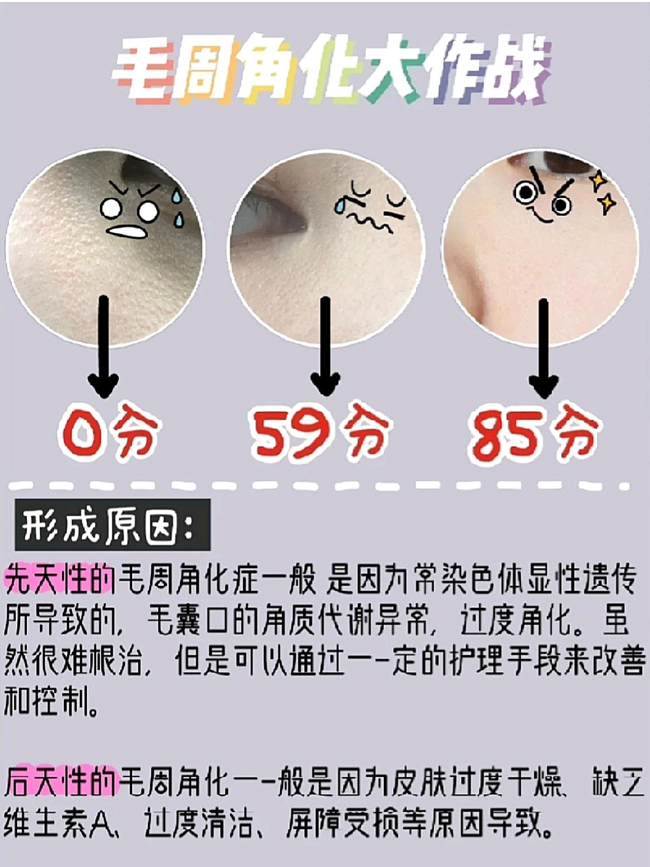 啥叫毛周角化 原来化妆不服帖脸脏全是因为它 怎么解 圈子 新氧美容整形