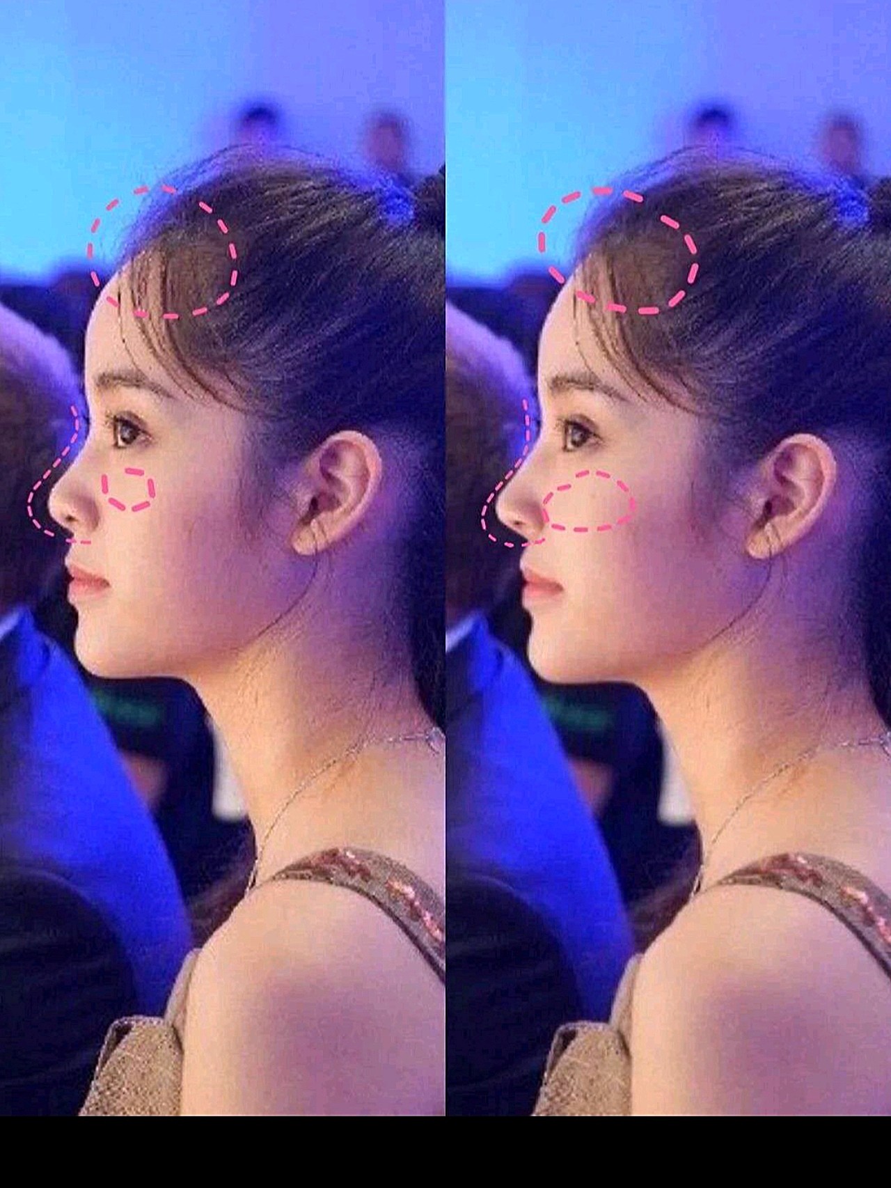 有没有那种正面看了惊艳,侧面却是短板的女明星?