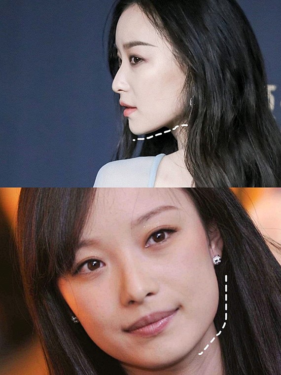 96最近的天真的是越来_圈子-新氧美容整形