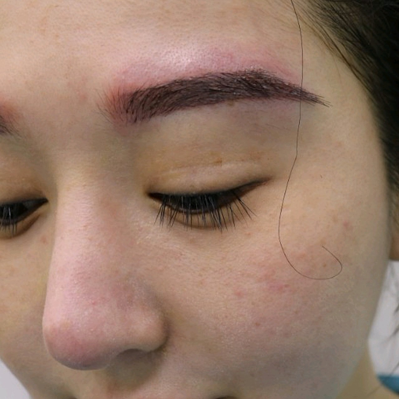 【种植眉毛】【特惠一口价】私信下单可返30% 微针私人定制眉毛 改善