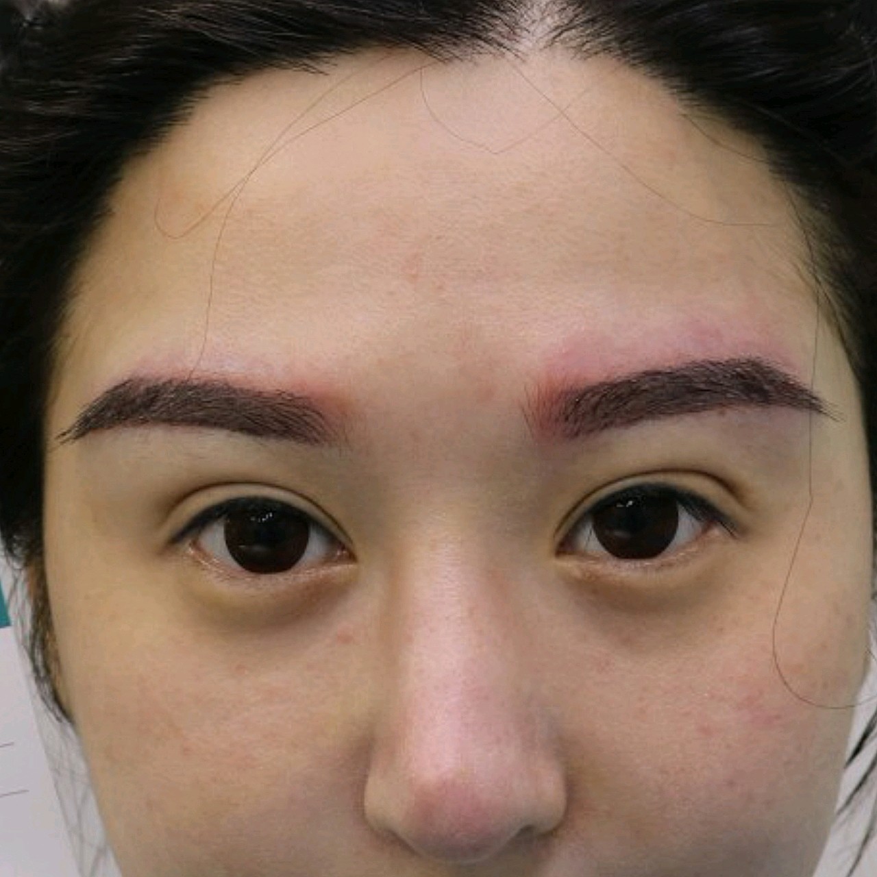 【种植眉毛】【特惠一口价】私信下单可返30% 微针私人定制眉毛 改善