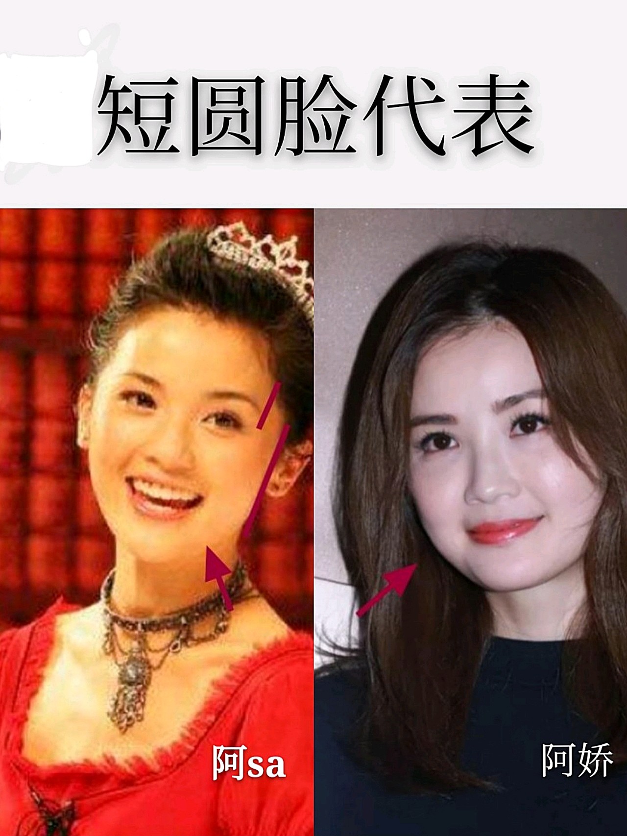 从太阳穴到颧骨到下颌,下巴,浑然天成的圆润,同时因为下颌角低,五官