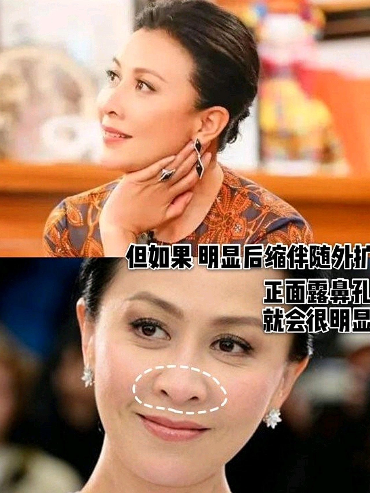 为什么你的正面能看到鼻孔0271