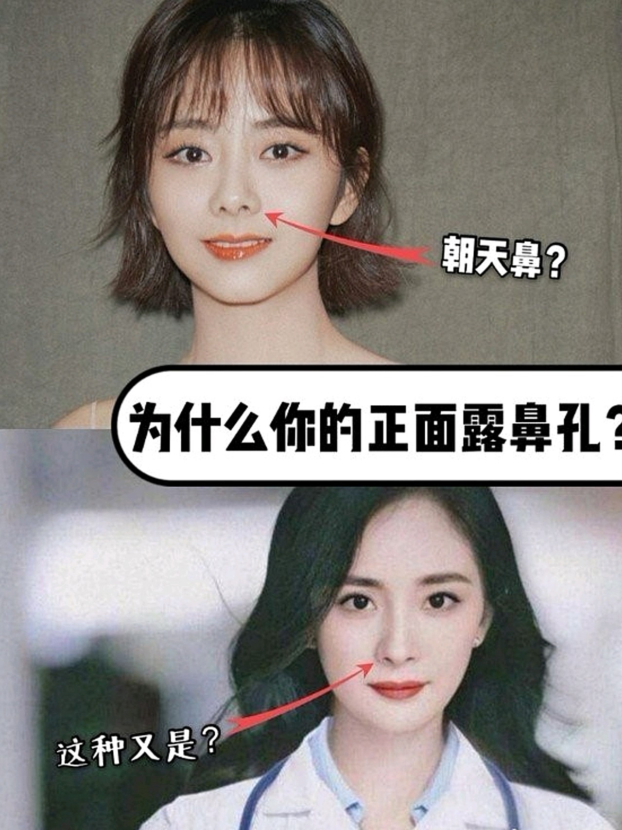 为什么你的正面能看到鼻孔0271