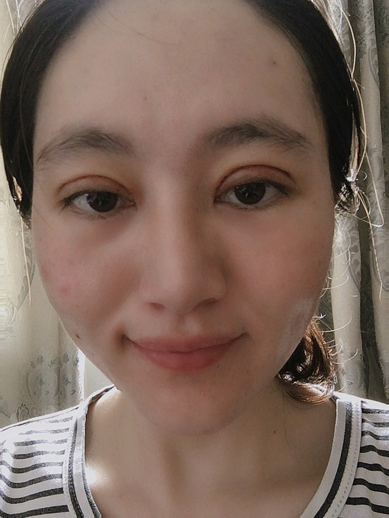 当当当,今天做完双眼皮手术第三天了,眼睛的肿胀感消_圈子-新氧美容