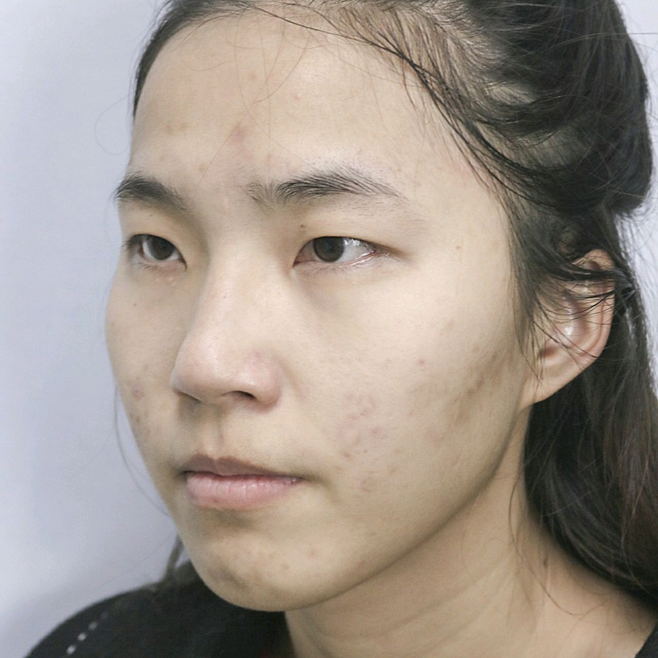 长期戴眼镜眼球又有点凸出来,眼睛看着无神又很小