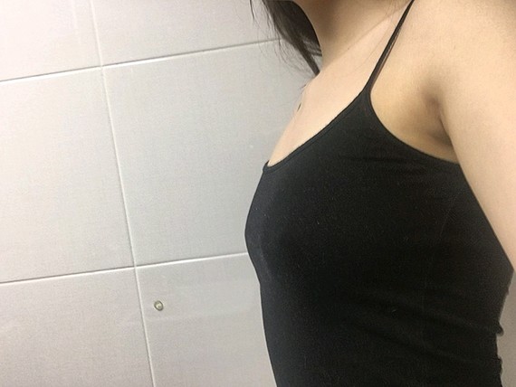 罩杯从a增大到b,形状我很喜欢,增大了之后显我的腰_圈子-新氧美容整形