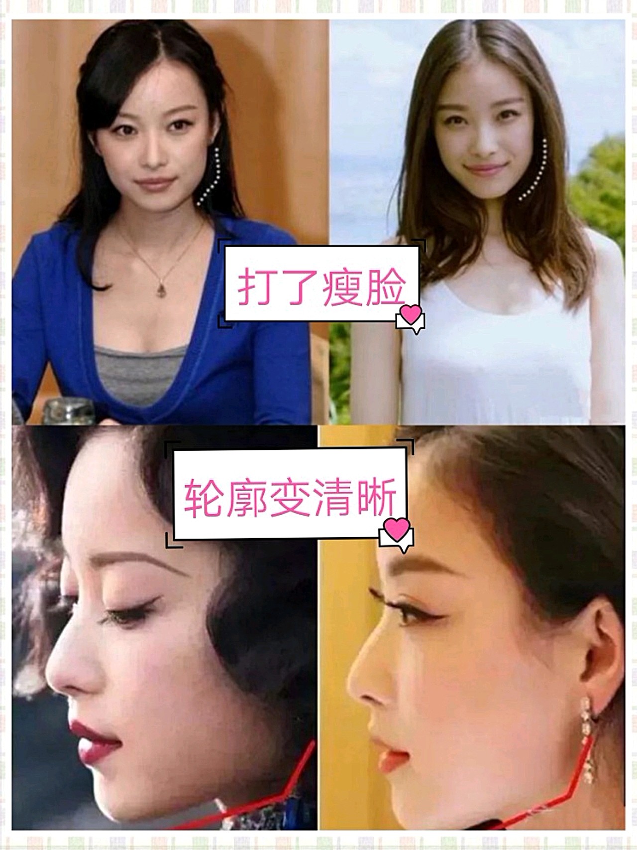 典型代表:倪妮,林允,舒淇…都不陌生吧 "鲶鱼脸"最主要特点眼距宽