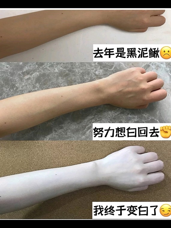 从头才到脚 我的美白心得 四从小皮肤偏黄属于 圈子 新氧美容整形